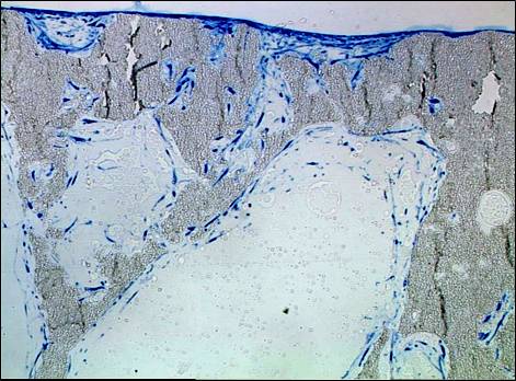 Invasion of a CaP bone substitute by fibroblasts